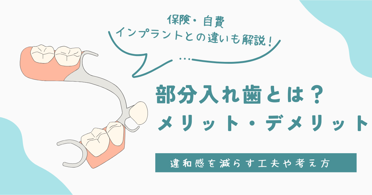 部分入れ歯とは?メリット・デメリットと違和感を減らす工夫 - まるもこブログ